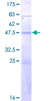 12.5% SDS-PAGE Stained with Coomassie Blue.